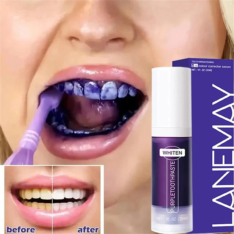 Toothpaste - 5D Teeth Whitening – Color Correction with V34 Purple Dye for Brighter, Whiter Teeth & Fresh Breath