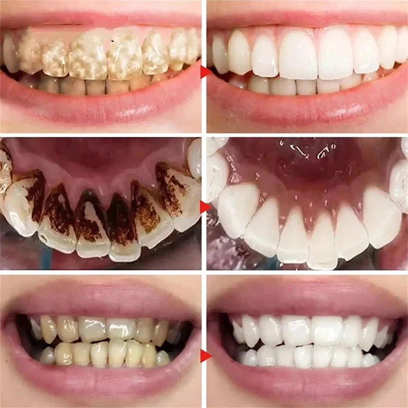 Toothpaste - 5D Teeth Whitening – Color Correction with V34 Purple Dye for Brighter, Whiter Teeth & Fresh Breath