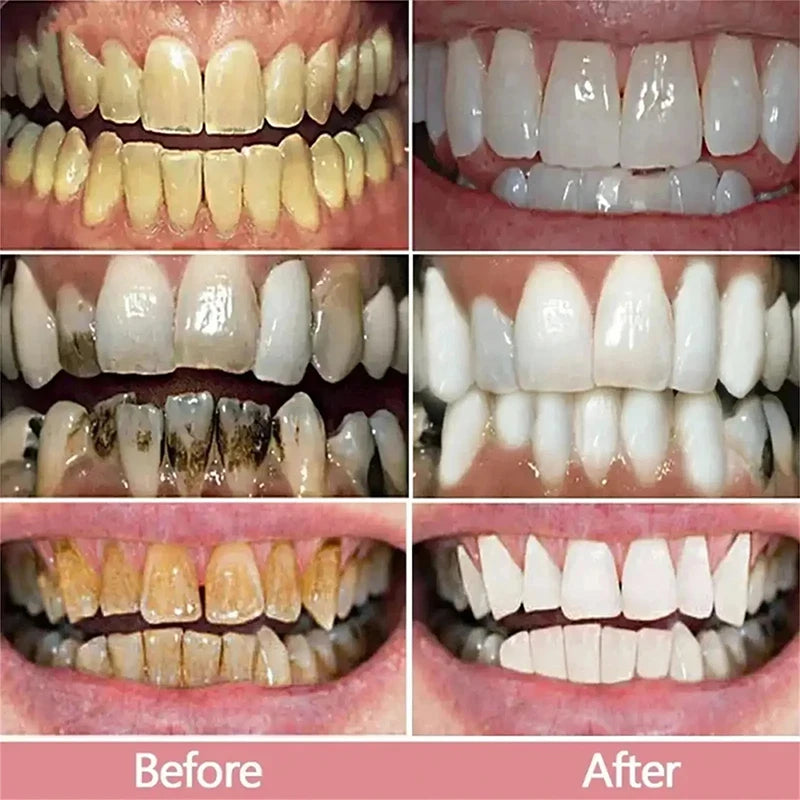 Toothpaste - 5D Teeth Whitening – Color Correction with V34 Purple Dye for Brighter, Whiter Teeth & Fresh Breath