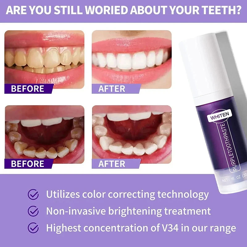Toothpaste - 5D Teeth Whitening – Color Correction with V34 Purple Dye for Brighter, Whiter Teeth & Fresh Breath